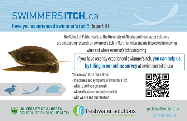 Swimmer's Itch